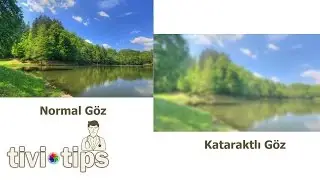Katarakt ameliyatı ne zaman yapılmalıdır?