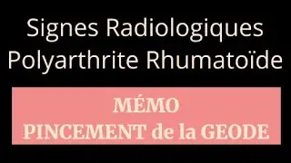 Mémo : Signes radiologiques de la Polyarthrite Rhumatoïde