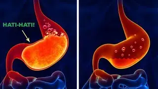 Bahaya Banget !! Begini Kondisi Tubuh Kita Jika Minum Alkohol