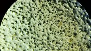 кристаллы мочевой кислоты в осадке мочи