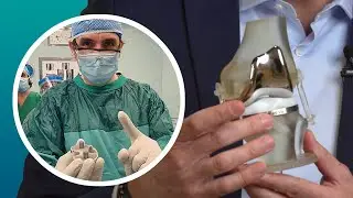 [LimaCorporate] 3D printing helps pioneer cementless knee replacements.