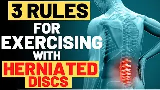 Exercising With Herniated Disc - 3 MUST FOLLOW Rules for exercising with herniated discs 2024