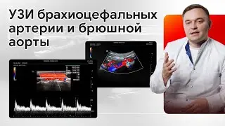 УЗИ брахиоцефальных артерии и брюшной аорты на Mindray Resona i9
