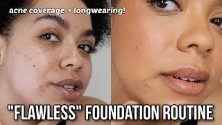 MY SKIN LOOKS TOO GOOD! Acne Foundation Routine, Longwearing + Glowy