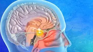 Endoscopic Transsphenoidal Pituitary Surgery Explained