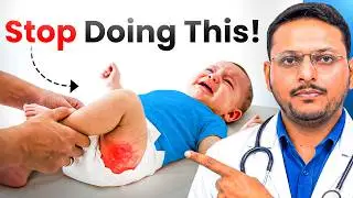 क्या बच्चों को रोज डायपर पहनाना सुरक्षित है ? | ​Diaper rash से कैसे बचें ? |  Dr. Sandip Gupta