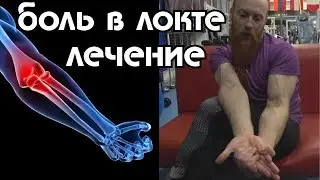 Болит локоть. Лечение 7 минут в день. Эпикондилит