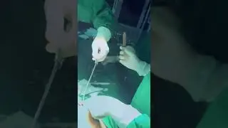 Day in the life - Ascites Drainage | @dr.bobrambe