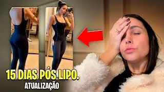 ATUALIZAÇÃO DA LIPO 15 DIAS DEPOIS. 😱😍 |*mostrando o corpo sem as placas.*