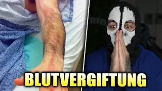 Moji hat eine Blutvergiftung😱