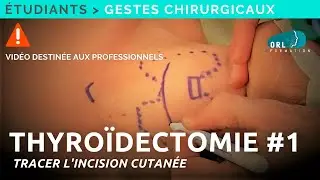 Comment réaliser une thyroïdectomie | #1 Tracer l'incision cutanée | Formation chirurgie ORL