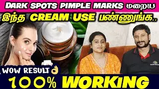 😍மங்கு மறைய இதை செய்யுங்க 👍 Remove Acne Scars, Dark Spots, Pimple Marks, Pigmentation #darkspots