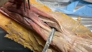 DORSAL FOREARM MUSCLES – ECRL ECRB ECU – SNUFFBOX – Extensor RETINACULUM Clinicals – Sanjoy Sanyal