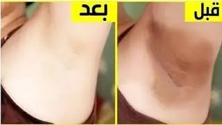 تبييض فوري للمهبل والشفرتين ضعيها كل يوم قبل النوم وستدهشك النتيجة هديتي للعرائس