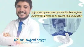 #Horlama Tedavisi Hasta Yorumları: Ağır uyku apnem vardı. Geceleri 260 kez nefesim duruyordu