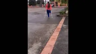 amputee in street