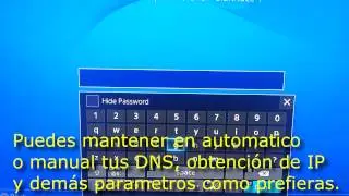 Como cambiar el MTU de tu consola para evitar desconecciones en Destiny