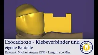 2020-Exocad-Plovdiv - Tutorial -  Klebeverbinder und eigene Bauteile