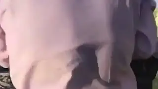 Собака укусила ногу))
