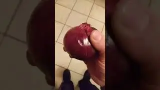 onion