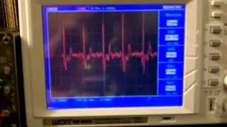 Arduino ECG  EKG Heart rate monitor circuit prototype