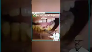 Meus dentes estão caindo
