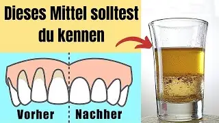 Dieses unglaubliches Mittel gegen Zahnfleischrückgang solltest du kennen
