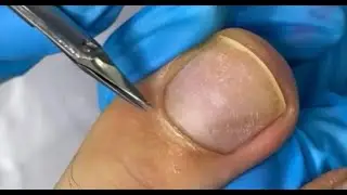 Срез кутикулы ножницами✂️• Полировка кутикулы🦶🏻 • Извлечение органики🤭👀✅