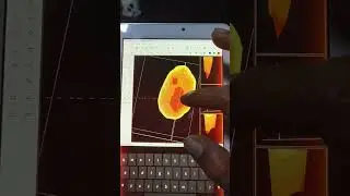 how to red scanning results image from Mariya technology scanner