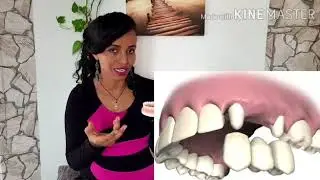 የጥርስ ውበት መጠበቂያ መንገዶች