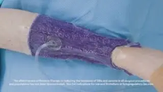 3M™ Prevena™ Therapy Tips and Tricks Video Orthopedic Ankle