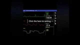 Berry Monitor App Operation Android