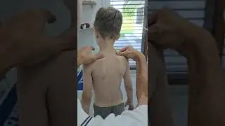 🌞OLIVER – SKOLIÓZA 20° JE PREČ!🌞 New Way terapeut - Zdenko