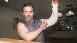 Bicep Tear Update