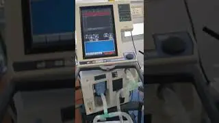 Splitting the ventilator to ventilate 2 patients by using t-piece