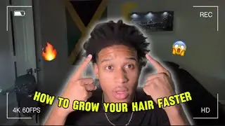 THIS IS WHAT GREW MY HAIR IN 2 MONTHS (easy method) 2025 