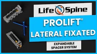 ProLift Lateral Fixated Expandable Spacer System