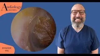 DIFFICULT EAR WAX REMOVAL FROM A NARROW EAR CANAL -EP773