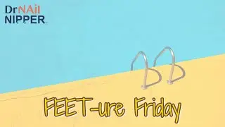 FEET-ure Friday |   Let's take out a cyst today 👩🏻‍⚕️🦶👣🦵🚶🏃