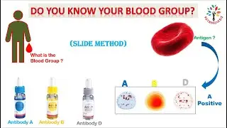 ABO blood typing ll slide method ll 