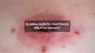 COME AVERE IL VISO SENZA BRUFOLI