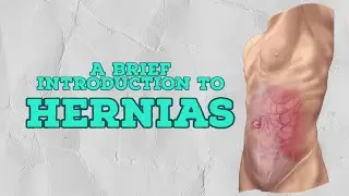 Introduction to Hernias