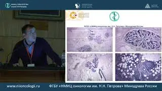 Лекарственная терапия рака молочной железы