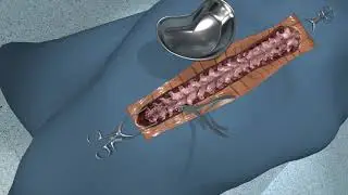 Spine - VR Simulation