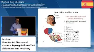 How Mental Stress and Vascular Dysregulation Affect Vision Loss and Recovery (Spanish Version)