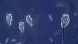 Vorticella