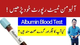 Albumin Blood Test In Urdu Hindi - Irfan Azeem