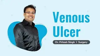 Venous Ulcer | Dr. Pritesh Singh | Surgery | PrepLadder