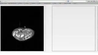 Dicom-Viewer-3