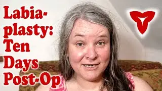 Labiaplasty Day 10 — Back At Work and Feeling Good